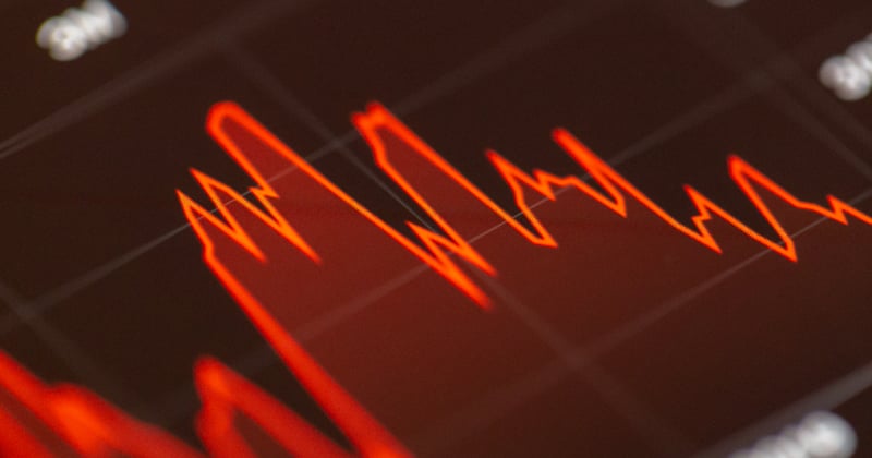 Comment analyser le bilan et le compte de résultat pour piloter votre entreprise